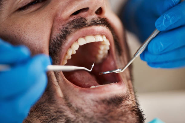 Best Broken Tooth Emergency  in Footville, WI
